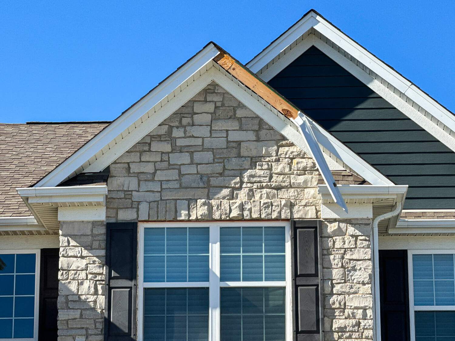 Before Fascia Repair